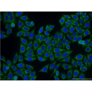 SAMSN1 Rabbit Polyclonal Antibody (13063-1-AP)