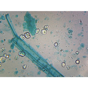 Prepared Microscope Slide,Anabaena, Filamentous Cyanobacteria