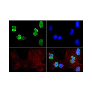 Anti-Histone H3 [ac Lys9, ac Lys14] (RABBIT) Antibody, 50µg, Liquid (sterile filtered)