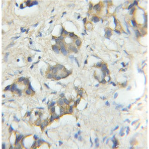 TRIM5 Rabbit Polyclonal Antibody (11476-1-AP)