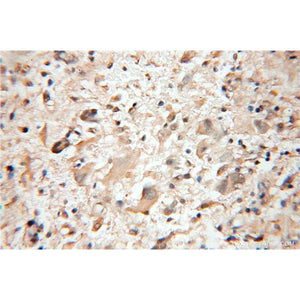 PTS Rabbit Polyclonal Antibody (12150-1-AP)