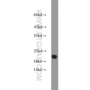 RGS10 Rabbit Polyclonal Antibody (11163-1-AP)