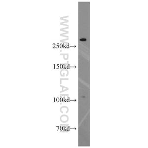 XIRP2 Rabbit Polyclonal Antibody (11896-1-AP)