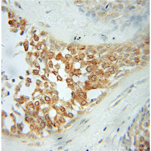 PLDN Rabbit Polyclonal Antibody (10891-2-AP)