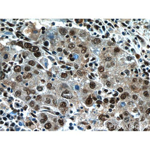 NFKB2 Rabbit Polyclonal Antibody (10409-2-AP)