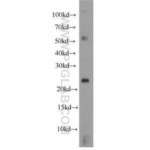 RHOC Rabbit Polyclonal Antibody (10632-1-AP)
