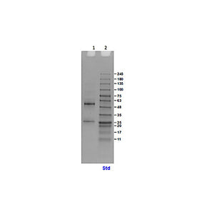 HUMAN IgM whole molecule Phycoerythrin conjugated, 0.25mL