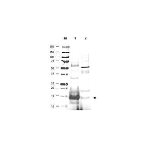 Anti-UBC13 [GOAT] Antibody, 100µg, Liquid (sterile filtered)