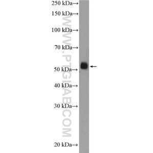 FICD Rabbit Polyclonal Antibody (11974-1-AP)