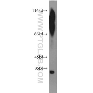 MEST Rabbit Polyclonal Antibody (11118-1-AP)