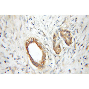 RABAC1 Rabbit Polyclonal Antibody (10542-1-AP)