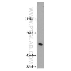 LRDD Rabbit Polyclonal Antibody (12119-1-AP)