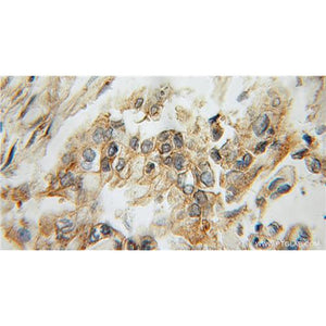 AMY2B Rabbit Polyclonal Antibody (12540-1-AP)