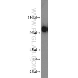 RHOT2 Rabbit Polyclonal Antibody (11237-1-AP)