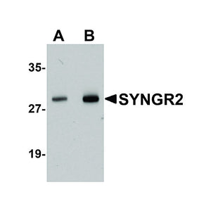 Anti-SYNGR2 (RABBIT) Antibody, 100µg, Liquid (sterile filtered)