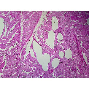 Prepared Microscope Slide,Lung, Section Human, showing Alveoli