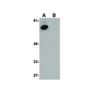 Anti-ACVR1B (RABBIT) Antibody, 100µg, Liquid (sterile filtered)