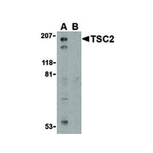 TSC2 Antibody cterm 100µg