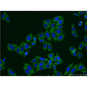 TAGLN2 Rabbit Polyclonal Antibody (10234-2-AP)