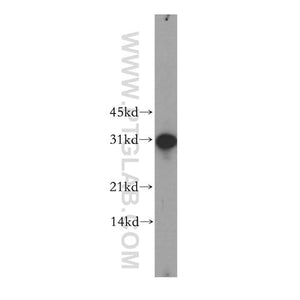 GJB3 Rabbit Polyclonal Antibody (12880-1-AP)