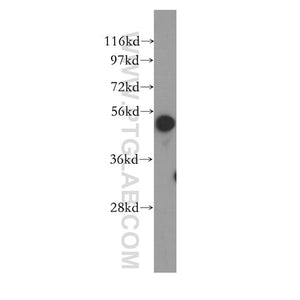 HNRNPK Rabbit Polyclonal Antibody (11426-1-AP)