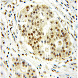 DRAP1 Rabbit Polyclonal Antibody (11020-1-AP)