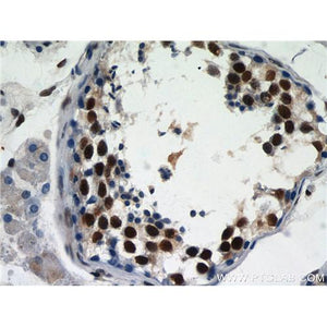 GABPB1 Rabbit Polyclonal Antibody (12597-1-AP)