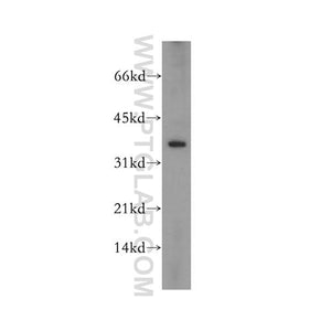 RPP38 Rabbit Polyclonal Antibody (12874-1-AP)