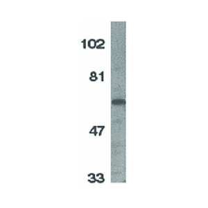 IL-1RAcP Antibody 100µg