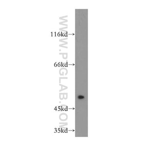 FGFR1OP Rabbit Polyclonal Antibody (11343-1-AP)