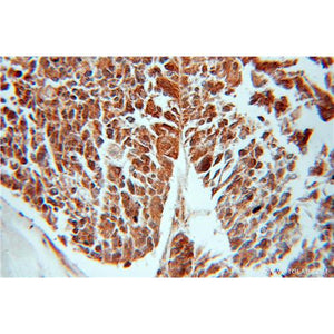 GNB5 Rabbit Polyclonal Antibody (11045-2-AP)