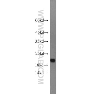 CDO1 Rabbit Polyclonal Antibody (12589-1-AP)