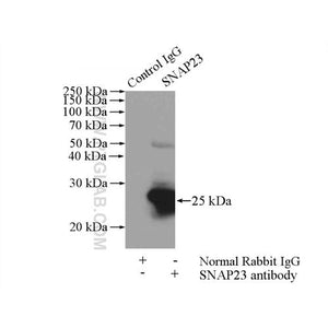 SNAP23 Rabbit Polyclonal Antibody (10825-1-AP)