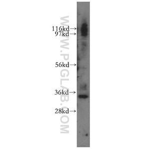 GTF2E2 Rabbit Polyclonal Antibody (11596-1-AP)