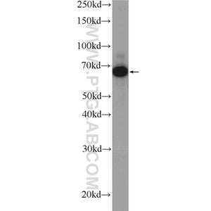 PLS3 Rabbit Polyclonal Antibody (12917-1-AP)