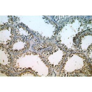 TAF1B Rabbit Polyclonal Antibody (12818-1-AP)