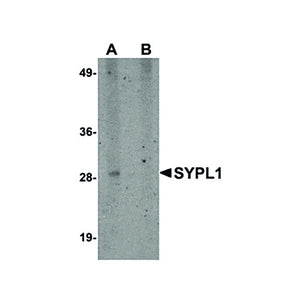 Anti-SYPL1 (RABBIT) Antibody, 100µg, Liquid (sterile filtered)