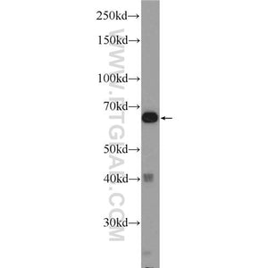 EDEM2 Rabbit Polyclonal Antibody (11241-1-AP)