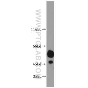 PRKACB Rabbit Polyclonal Antibody (12232-1-AP)