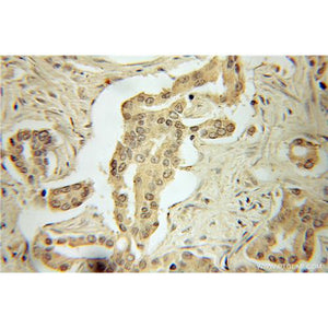 PRKAA1 Rabbit Polyclonal Antibody (10929-2-AP)