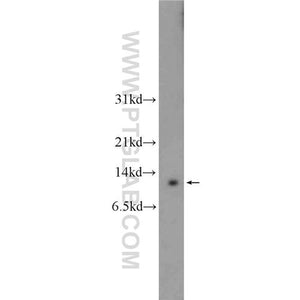 HOPX Rabbit Polyclonal Antibody (11419-1-AP)