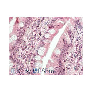 HDAC9 (N-terminus) Antibody 100µg