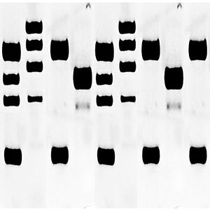 Human Normal & Tumor Pancreas Tissue Blot