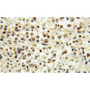 E2F4 Rabbit Polyclonal Antibody (10923-1-AP)