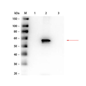 AKT2 Antibody Combo Pack, 1Pack,  Liquid and Lyophilized