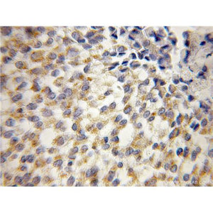 UQCRH Rabbit Polyclonal Antibody (12364-1-AP)