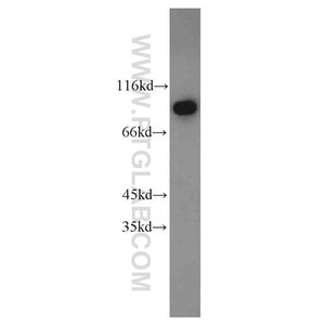 DDX50 Rabbit Polyclonal Antibody (10358-1-AP)