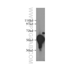 DYRK1B Rabbit Polyclonal Antibody (12240-1-AP)