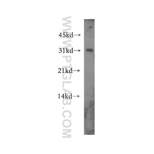 APH1A Rabbit Polyclonal Antibody (11643-1-AP)