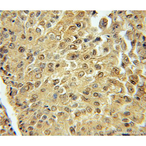 ARHGEF10 Rabbit Polyclonal Antibody (11112-1-AP)